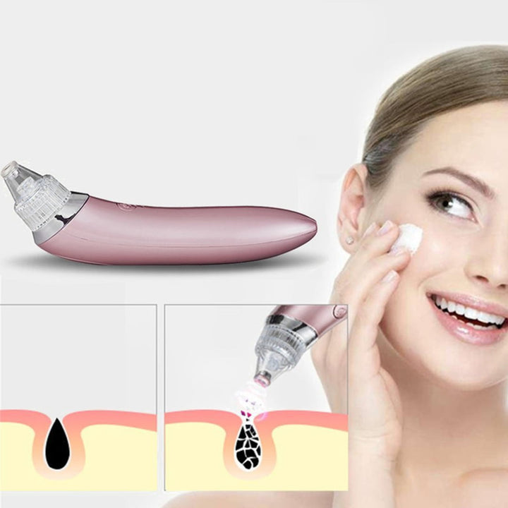 Blackhead Vacuum Acne Cleaner Pore Remover Electric Skin Facial Cleanser Care